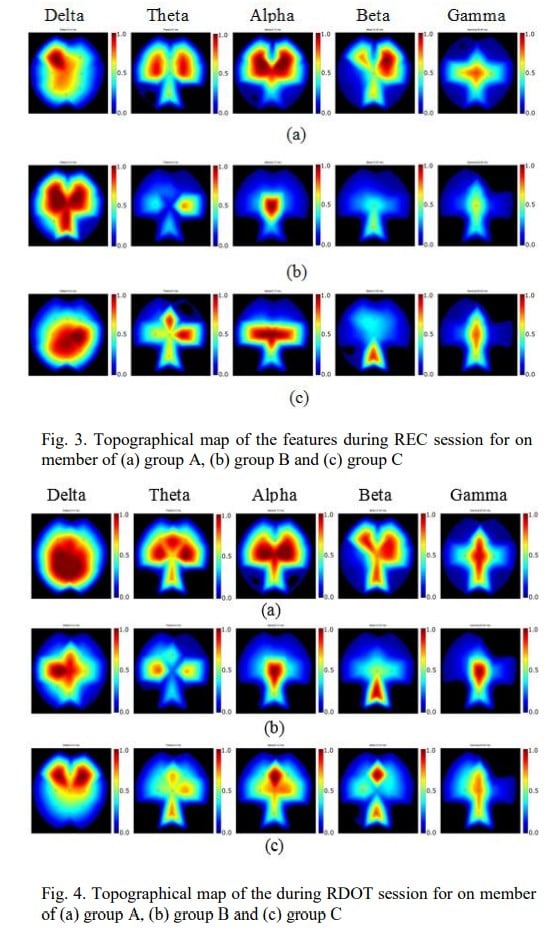 Om swmai brain scans