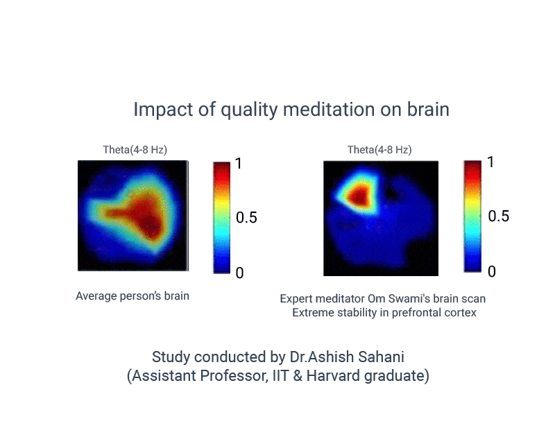 Om swami brain scans